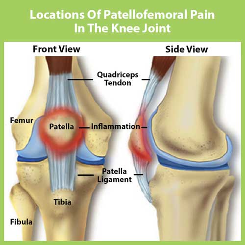 Knee B (thekneejoint.com)